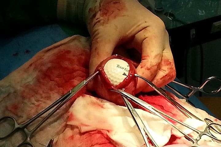 A gloved hand holds a partially opened bloodied sphere surrounded by surgical tools. Inside, visible is a piece of paper or label with text. The setting resembles a surgical environment, covered in red fabric and medical instruments.